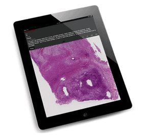 Image: SlidePath Gateway provides access to high quality whole slide images captured on the Leica SCN400 slide (Photo courtesy of Leica Microsystems).